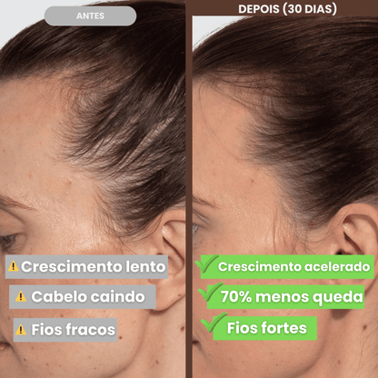 Shampoo e condicionador para crescimento e fortalecimento + Sérum Capilar de BRINDE!